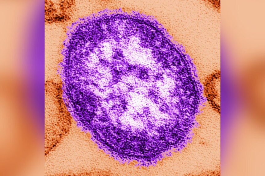 quebec-measles-outbreak-grows-to-11-cases;-officials-warn-of-thousands-of-exposures