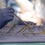 surgeries-scheduled-on-mondays-yield-better-results-than-those-performed-fridays,-study-finds