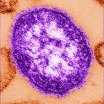 alberta-health-services-issues-measles-alert,-cases-reported-in-other-provinces