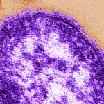 manitoba-warns-of-new-measles-exposure-sites-south-of-winnipeg