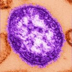 more-measles-cases-announced-in-bc-as-nationwide-infections-continue