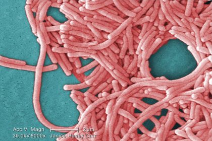 legionnaires’-disease-outbreak-leaves-one-dead,-more-than-40-infected-in-london,-ontario