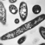 london,-ont.,-health-unit-identifies-source-of-legionnaires’-disease-outbreak